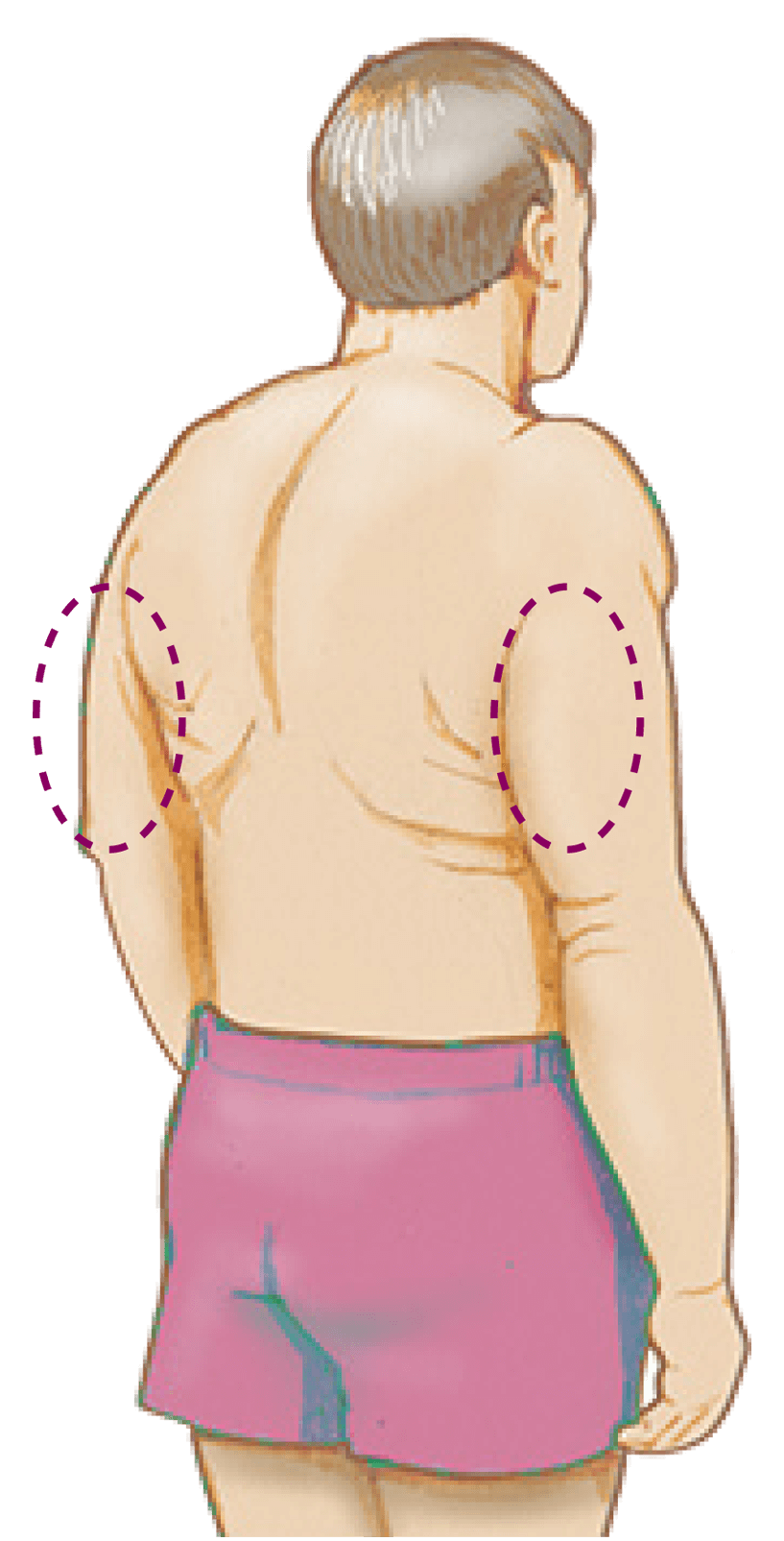 Freestylediabetesme — Applying The FreeStyle Libre Sensor