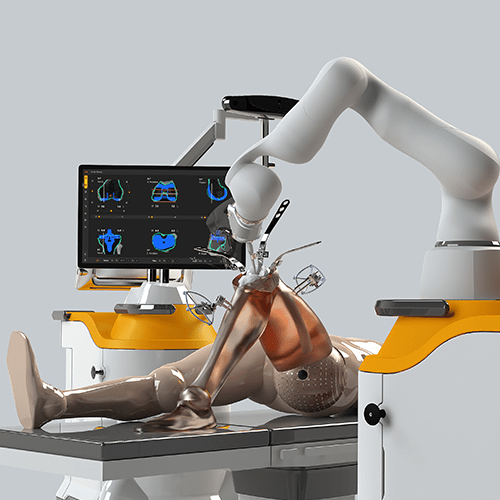 Best Robotic Knee Replacement Surgeon in Gwalior