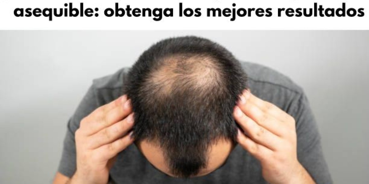 Tratamiento de Trasplante capilar asequible: obtenga los mejores resultados