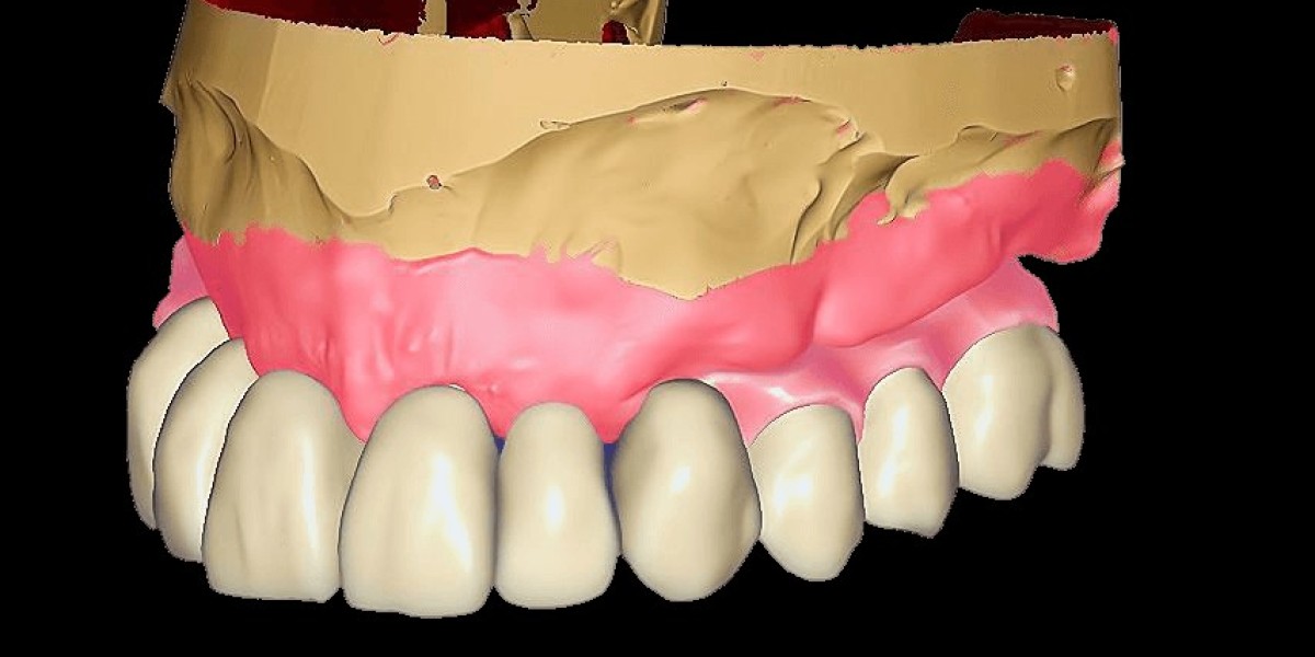 Revolutionizing Dental CAD Services: Your Go-To Remote Dental CAD Designer