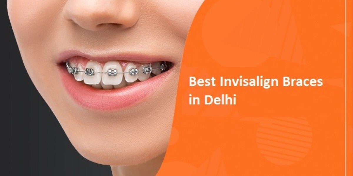 Best Braces For Teeth