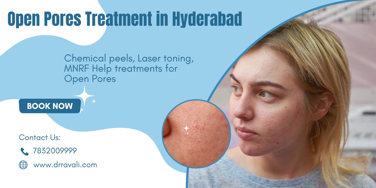 Professional Treatments for Minimizing Open Pores