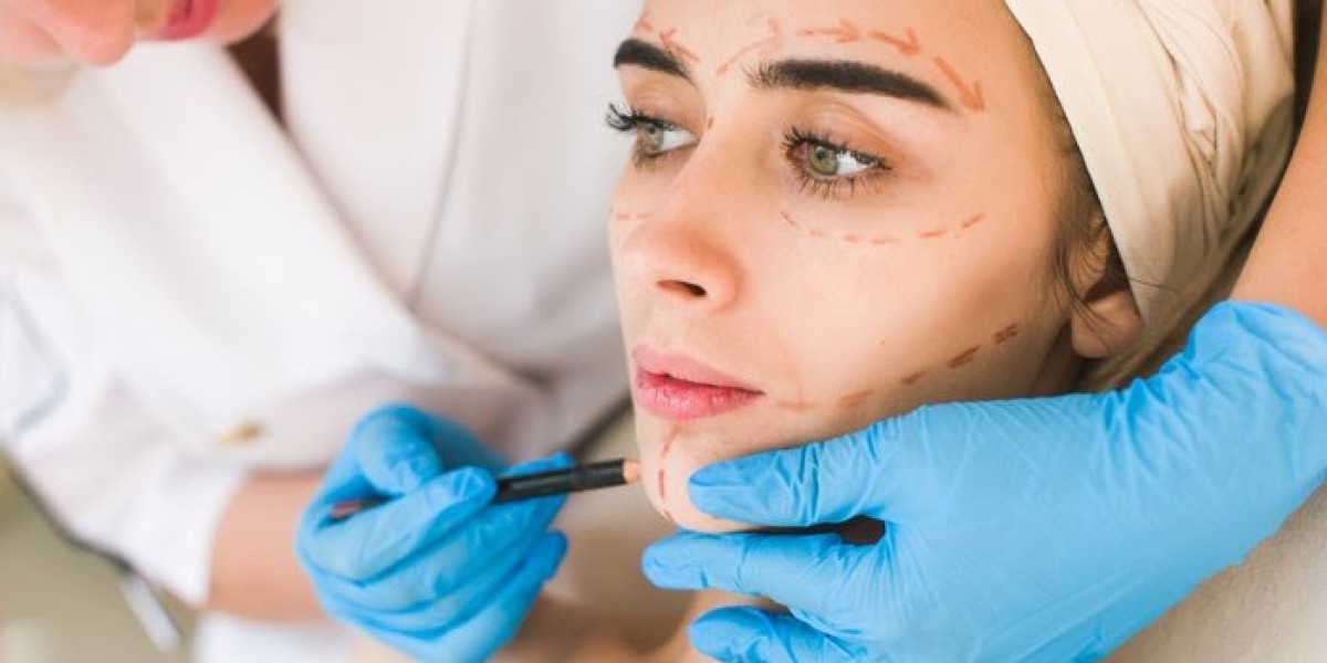 A Guide to Facelift For Men