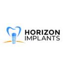 Horizon Implants Profile Picture