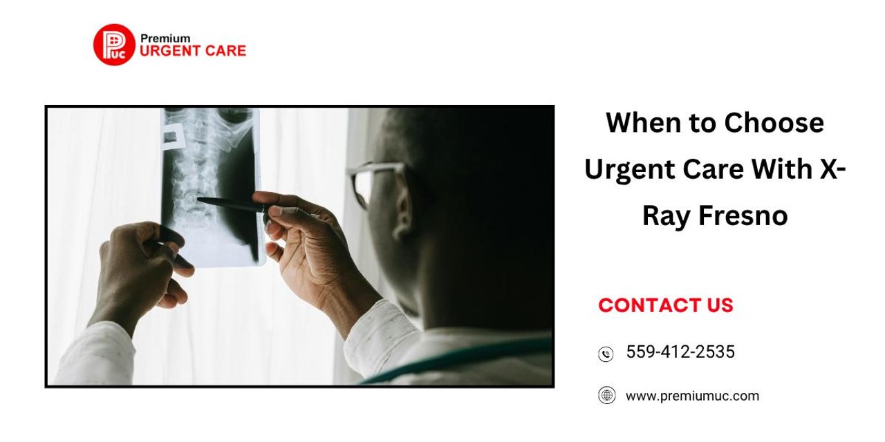 When to Choose Urgent Care With X-Ray Fresno | Articles | Premium Urgent Care | Gan Jing World - Technology for Humanity | Video & Movie Streaming